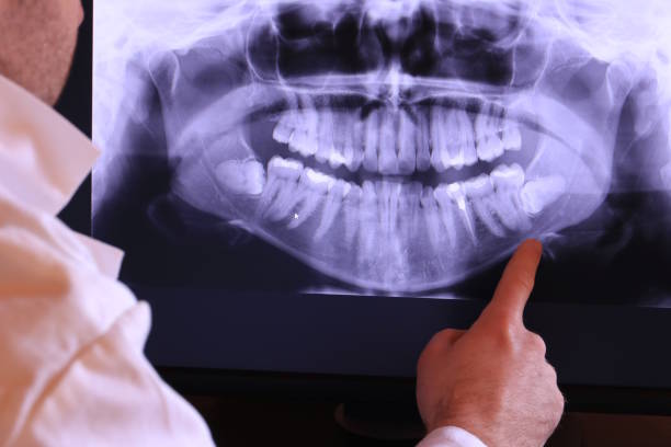 Best Dental Abscess Treatment in Lindsay, OK