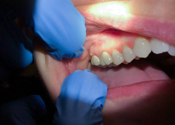 Professional Emergency Dental Service in OK